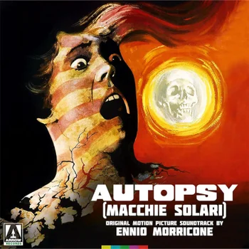 Autopsy | Black | Vinyl